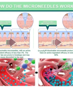 Grunsify® NIDDK-Tirzepatide Nano Microneedle Patch