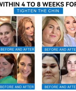 Grunsify® Nano-Microcrystal Patch: Tirzepatide + Collagen Dual Action for Fat Loss, Skin Tightening, and Sugar Control