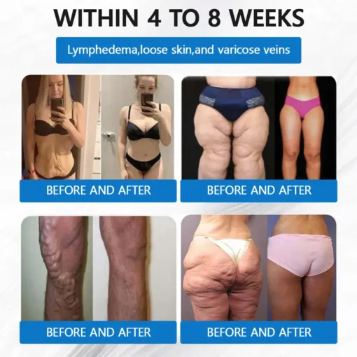 Grunsify® Nano-Microcrystal Patch: Tirzepatide + Collagen Dual Action for Fat Loss, Skin Tightening, and Sugar Control