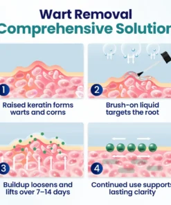 Grunsify® Wart Lift Corn Removal Liquid-No Recurrence After Cure